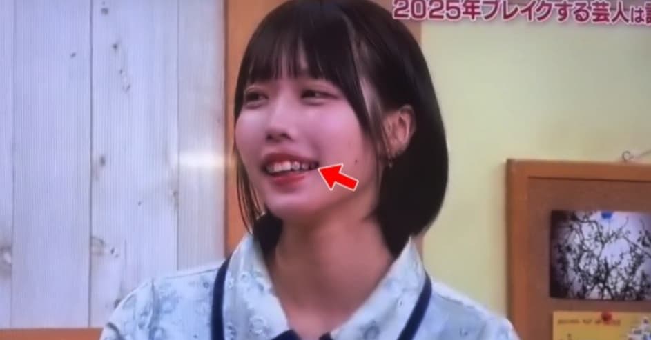 あのちゃんの歯ピアス徹底解剖！値段や安全性、独自の美学とは？